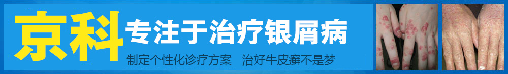 打造银屑病专科医院 让更多的患者